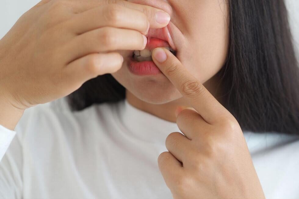 腫れた歯茎を見せている様子