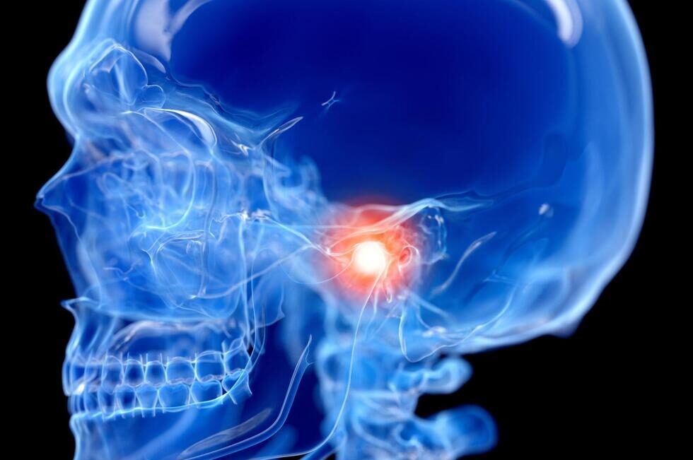 顎関節症を示す頭蓋骨のイラスト