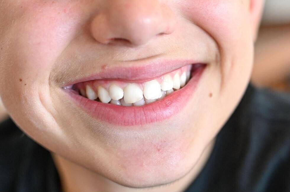 歯を見せて笑う口元